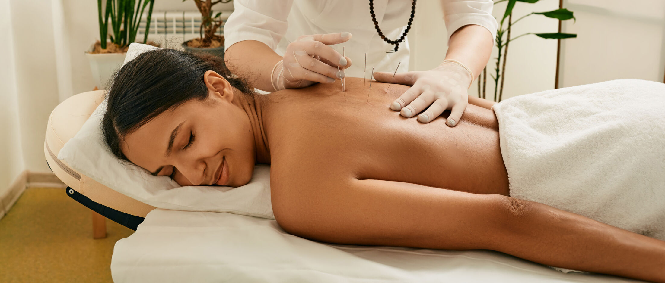 Acupuncture for a back of a young woman in a Chinese clinic. Back view